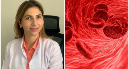 Hematoloq Gülnaz Bədəlova: “Anemiya xəstələri COVID-19-a qarşı daha həssasdırlar”